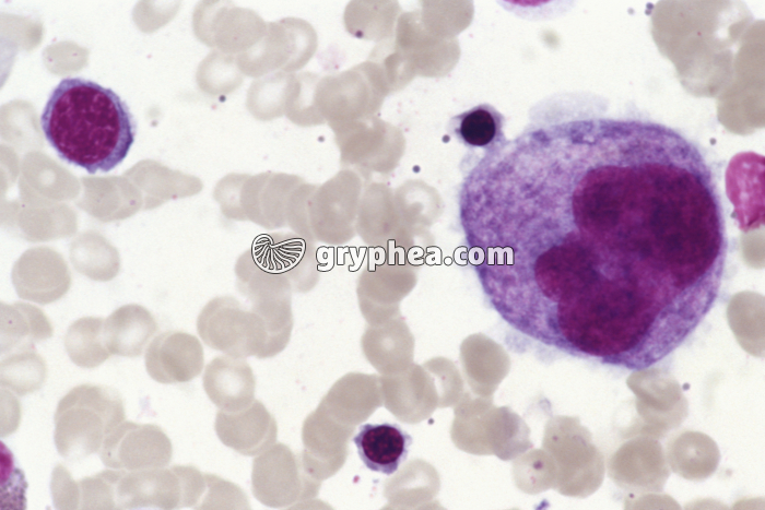 Moelle osseuse x170 - gryphea.org